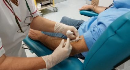 Insólito: Italia reporta a un paciente con viruela del mono, VIH y Covid-19 al mismo tiempo