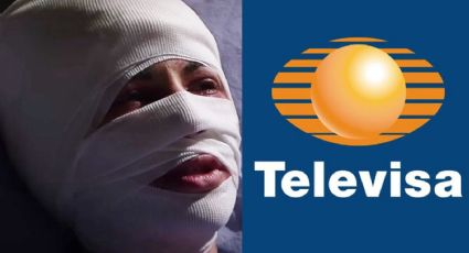 Se desfiguró: Tras dejar TV Azteca y 18 años retirada, protagonista de novelas vuelve a Televisa