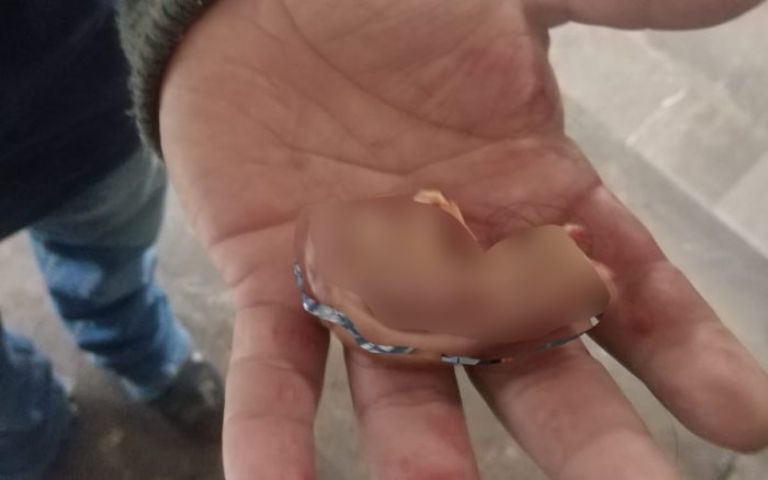 En la imagen, la oreja que, con los dientes, un sujeto le arrancó a otro. Foto: Twitter