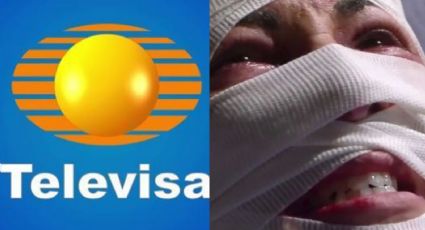 Adiós TV Azteca: Tras 18 años desaparecida y acabar desfigurada, actriz de novelas vuelve a Televisa