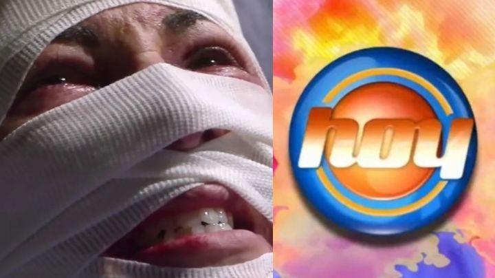 Adiós TV Azteca: Tras divorcio y retiro de Televisa, actriz llega a 'Hoy' desfigurada y en la ruina