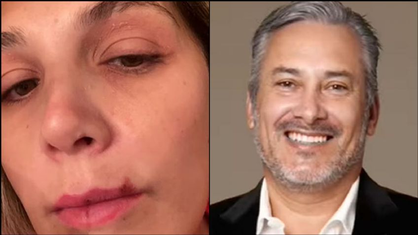 ¿Está en peligro? Estrella de 'Survivor' denuncia a su expareja con duras FOTOS: "Temo por mi vida"