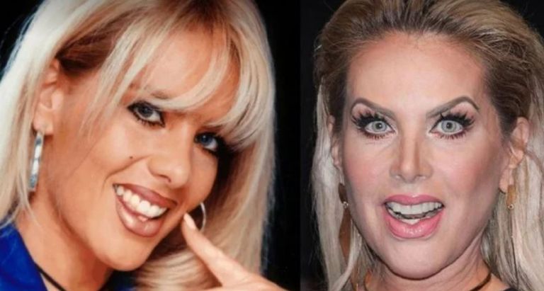 Antes y después de Lorena Herrera