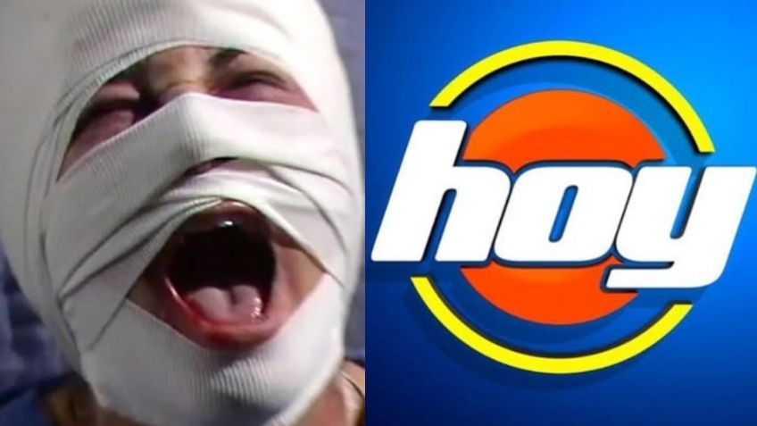 Desfigurada y en la ruina: Tras divorcio y renunciar a Televisa, exactriz de TV Azteca llega a 'Hoy'