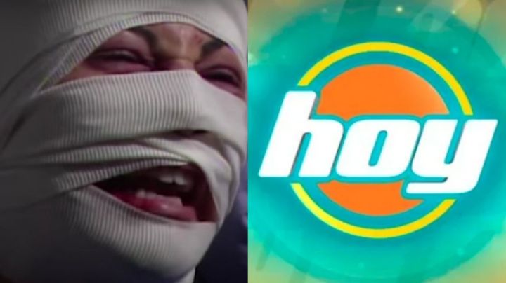 Desfigurada y en la ruina: Tras 18 años retirada de Televisa, exactriz de TV Azteca vuelve a 'Hoy'