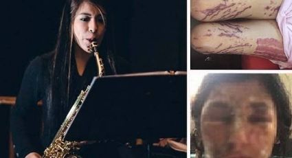 AMLO: Hombre que ordenó ataque con ácido a la saxofonista María Elena Ríos seguirá en prisión