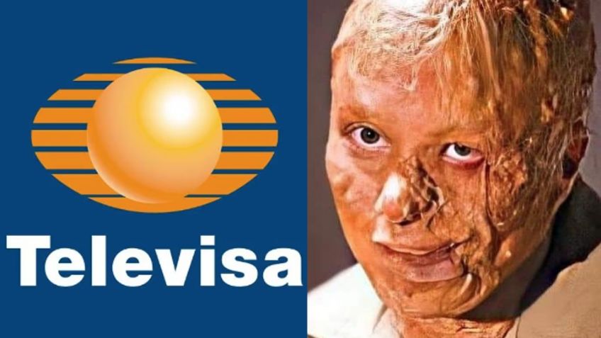 Se divorció: Tras acabar desfigurada y 10 años desaparecida, actriz vuelve con protagónico a Televisa