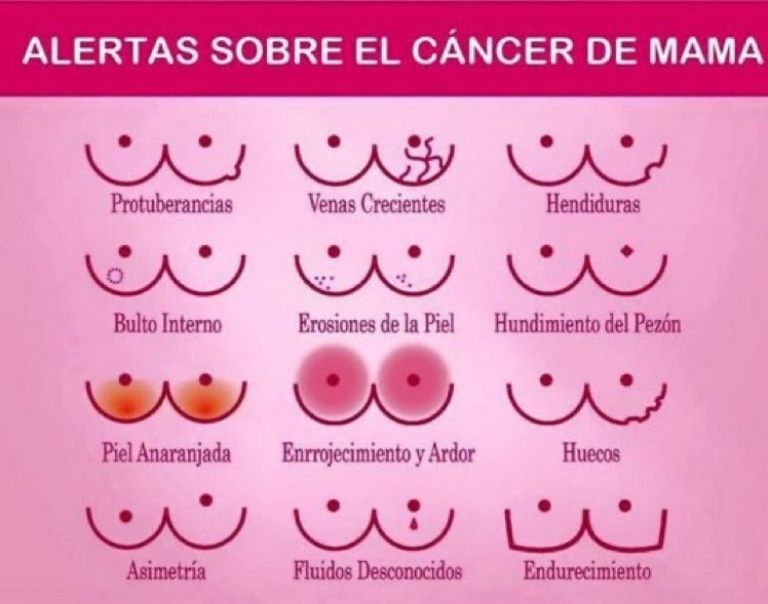 Detección de Cáncer de Mama