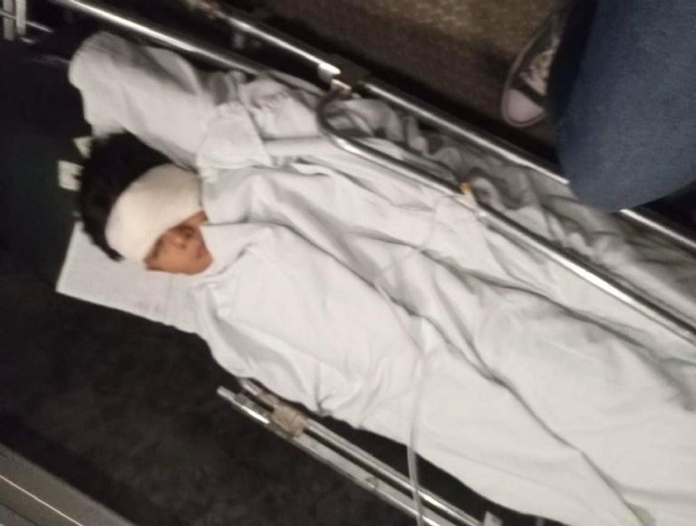 Un niño resultó herido tras ataque de perro pitbull en Guaymas. Foto: Cortesía