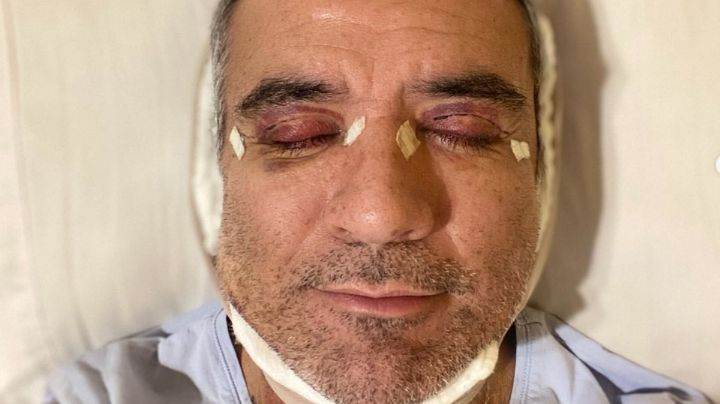 Tras dejar Telemundo, Héctor Sandarti estremece a sus fans al aparecer en cama de un hospital