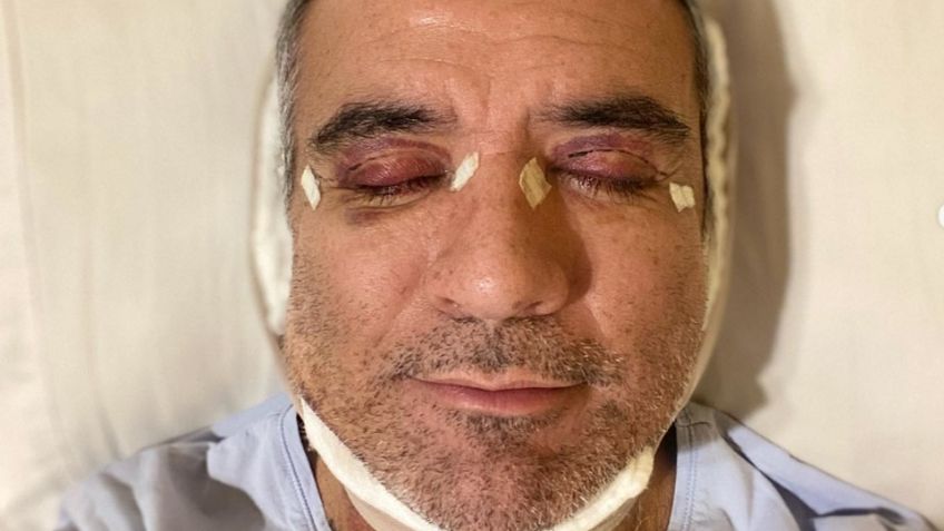 Tras dejar Telemundo, Héctor Sandarti estremece a sus fans al aparecer en cama de un hospital