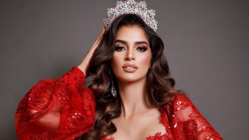 Miss Universo: La mexicana Melissa Flores sufre lesión previo a final; podría ir a quirófano