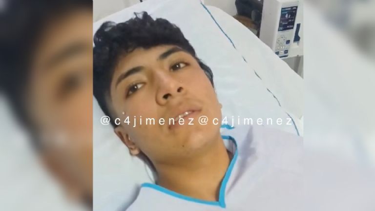 Estudiante en Texcoco Sufre Ataque Brutal: Rociado con Gasolina y Prendido en Fuego por Compañeros