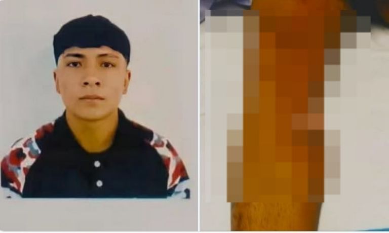 Joven agredido en Texcoco