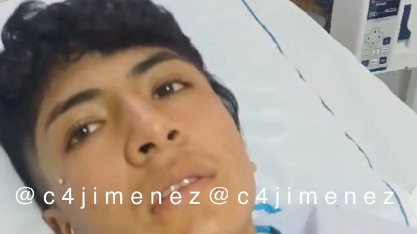 Reportan grave a Cristian, joven agredido con gasolina e incendiado en Texcoco