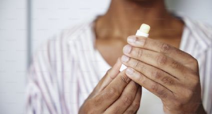 He aquí por qué tus labios están secos incluso después de usar un bálsamo, según un dermatólogo