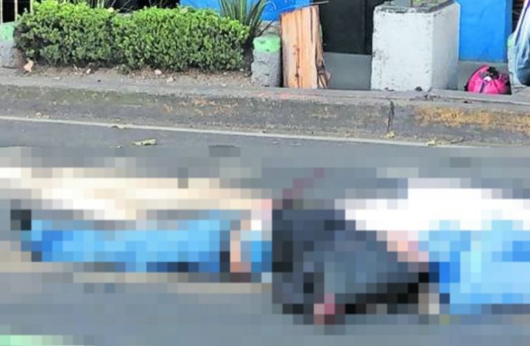 Motociclista pierde una pierna en la Cuauhtémoc