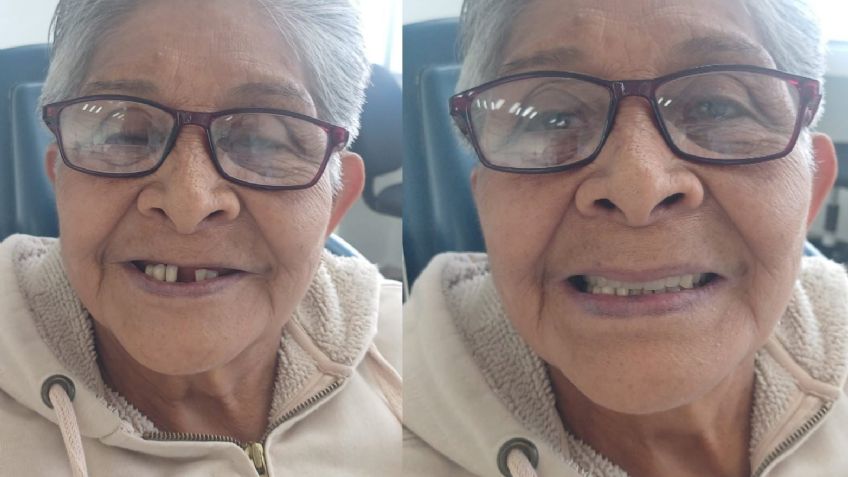 CDMX le regresa las sonrisas a los abuelitos con prótesis gratuitas; así es el registro