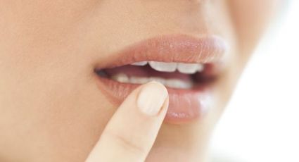 Herpes labial: 2 remedios con ingredientes de casa para curarte