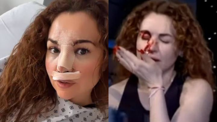 Tras sufrir aparatosa caída, Mayte Carranco reaparece en redes, ¿cómo se encuentra?