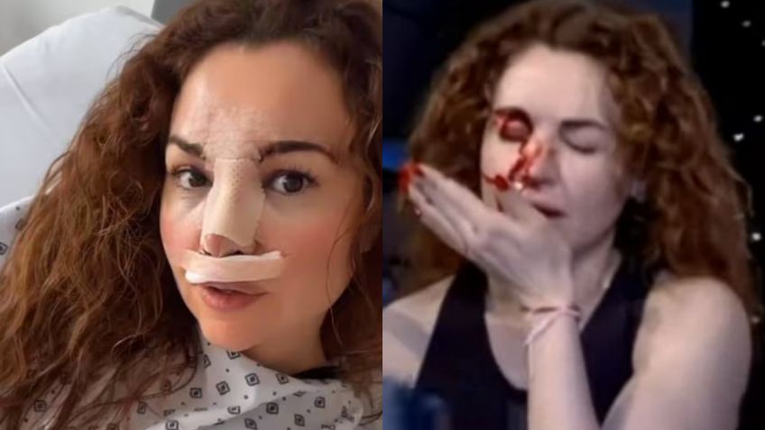 Tras sufrir aparatosa caída, Mayte Carranco reaparece en redes, ¿cómo se encuentra?