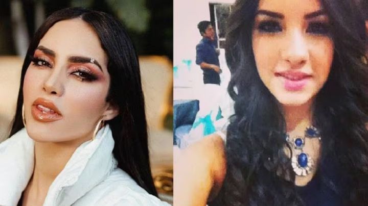 ¡Irreconocible! Mira cómo lucía Kimberly Loaiza antes de sus cirugías estéticas