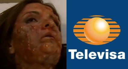 Acabó desfigurada: Tras llegar a 'VLA' y amorío con productor, villana confirma su regreso a Televisa