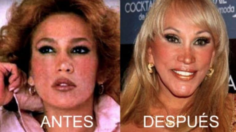 Laura León, antes y después