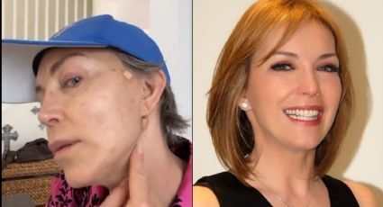 Televisa en shock: Tras huir del narco, Laura Flores reaparece con el rostro hinchado y moretones