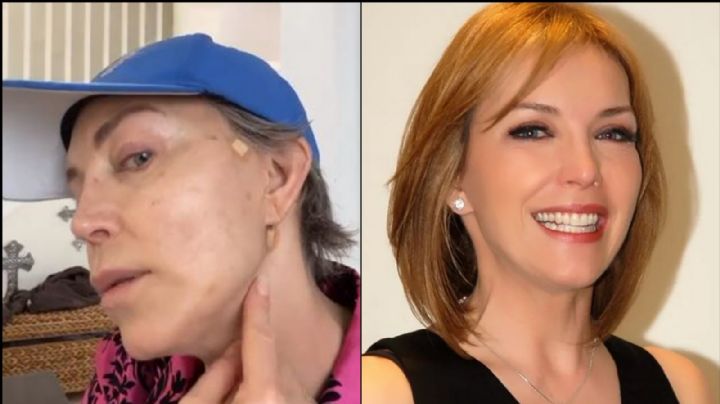 Televisa en shock: Tras huir del narco, Laura Flores reaparece con el rostro hinchado y moretones