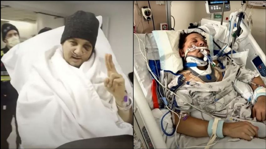 Querido actor sufre brutal accidente; se fractura 30 huesos y casi pierde un ojo