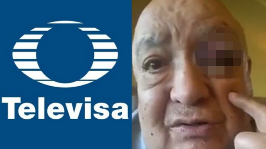 En silla de ruedas y golpeado: Luis de Alba sufre terrible accidente y estremece a Televisa en VIDEO