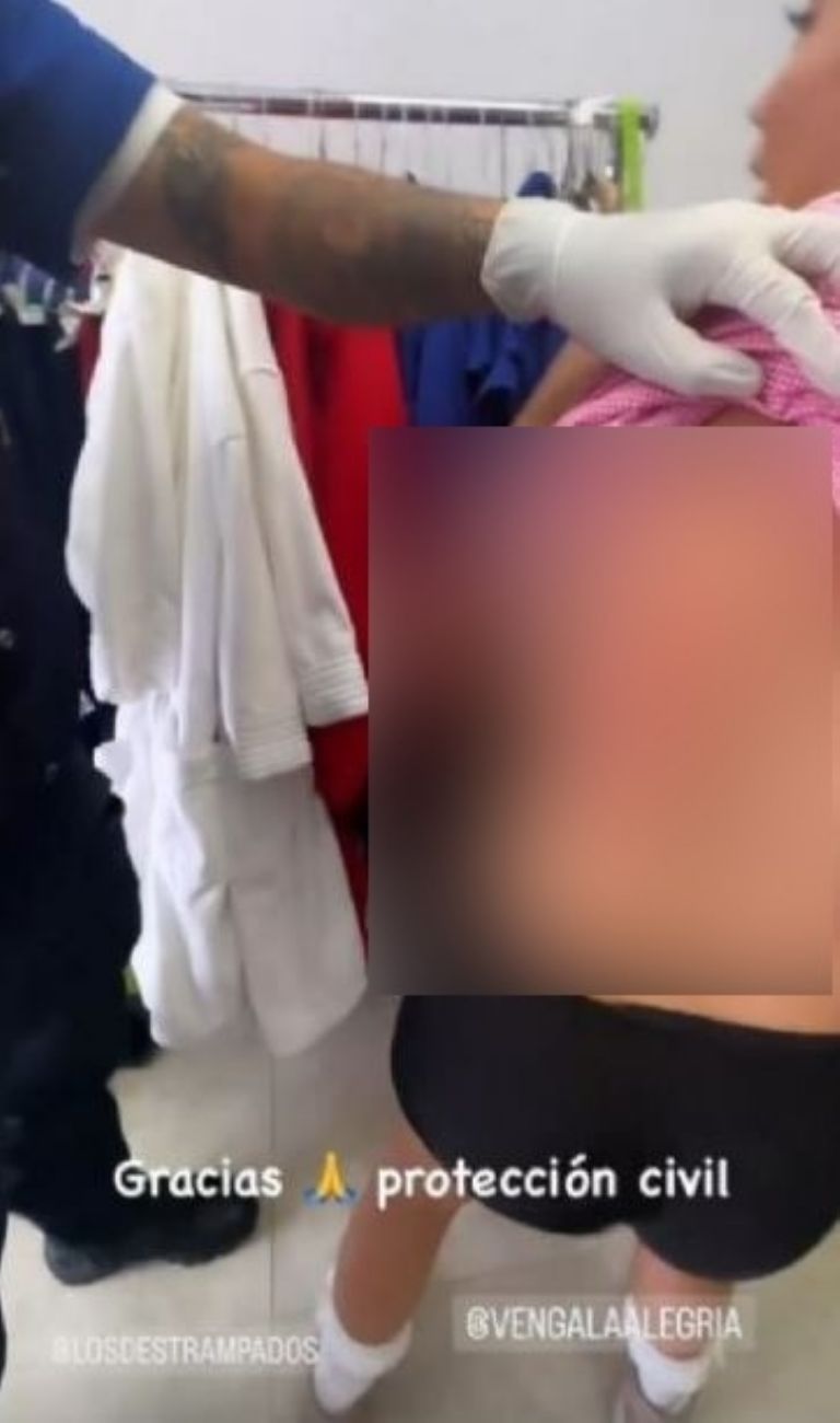 Quemadura de Tábata Jalil