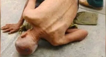 (VIDEO) Alarmante: Por falta de alimento, hombre de la tercera edad se desmaya en la vía pública