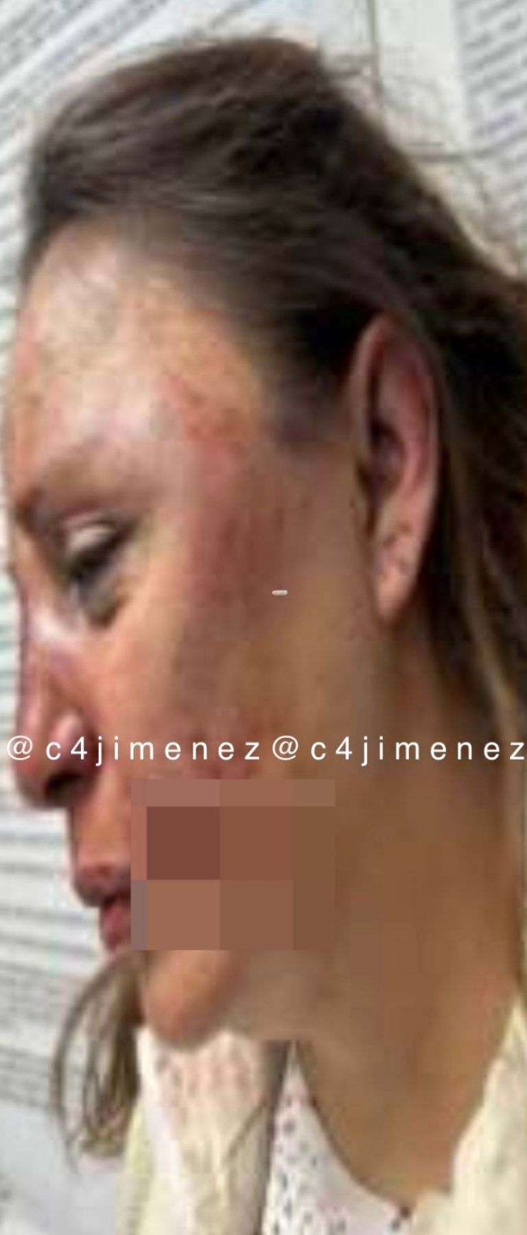 Mujer golpeada en Tepito