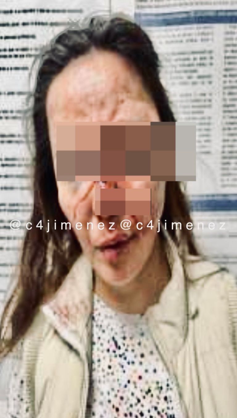 Mujer golpeada en Tepito