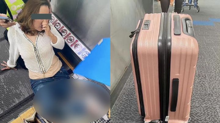 IMAGEN FUERTE: Turista pierde una pierna tras quedar atorada en la banda eléctrica de un aeropuerto