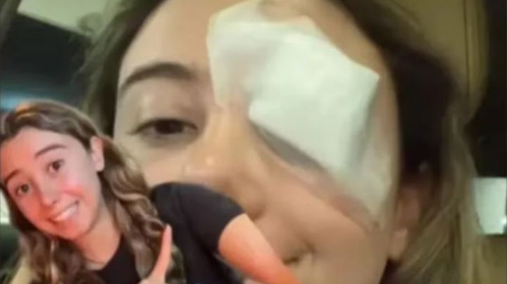 Chica termina en el hospital tras seguir consejo de belleza viral en TikTok; la tuvieron que operar