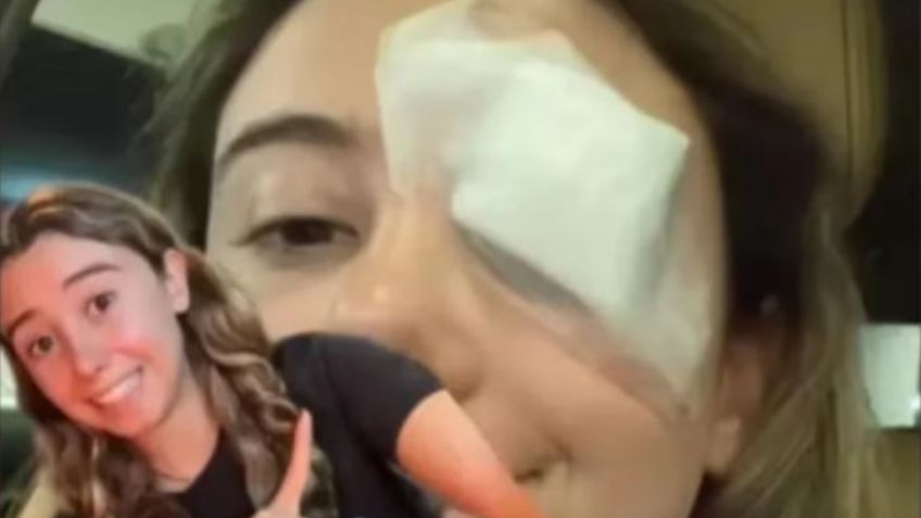 Chica termina en el hospital tras seguir consejo de belleza viral en TikTok; la tuvieron que operar
