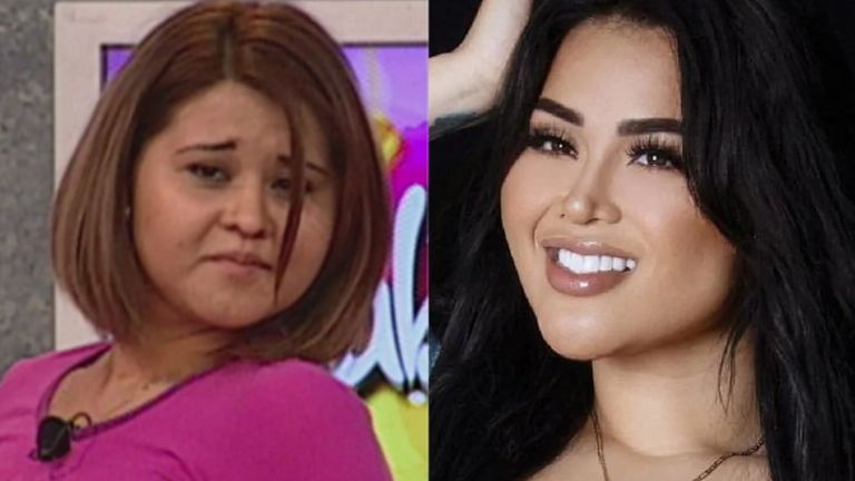 Antes y después de Gomita