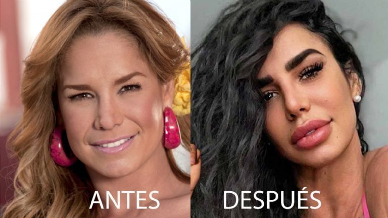 Antes y después de Lis Vega