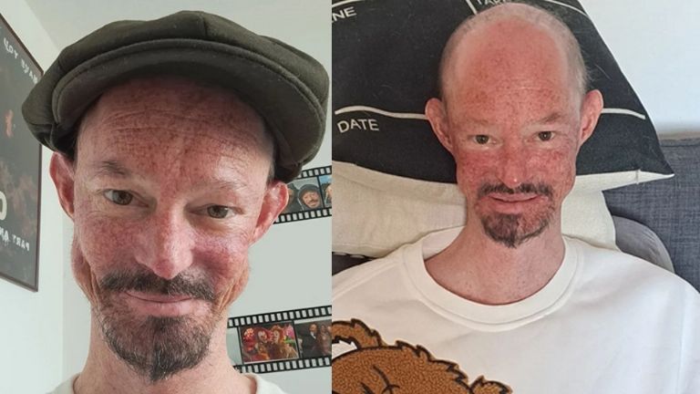 El actor Darren Kent