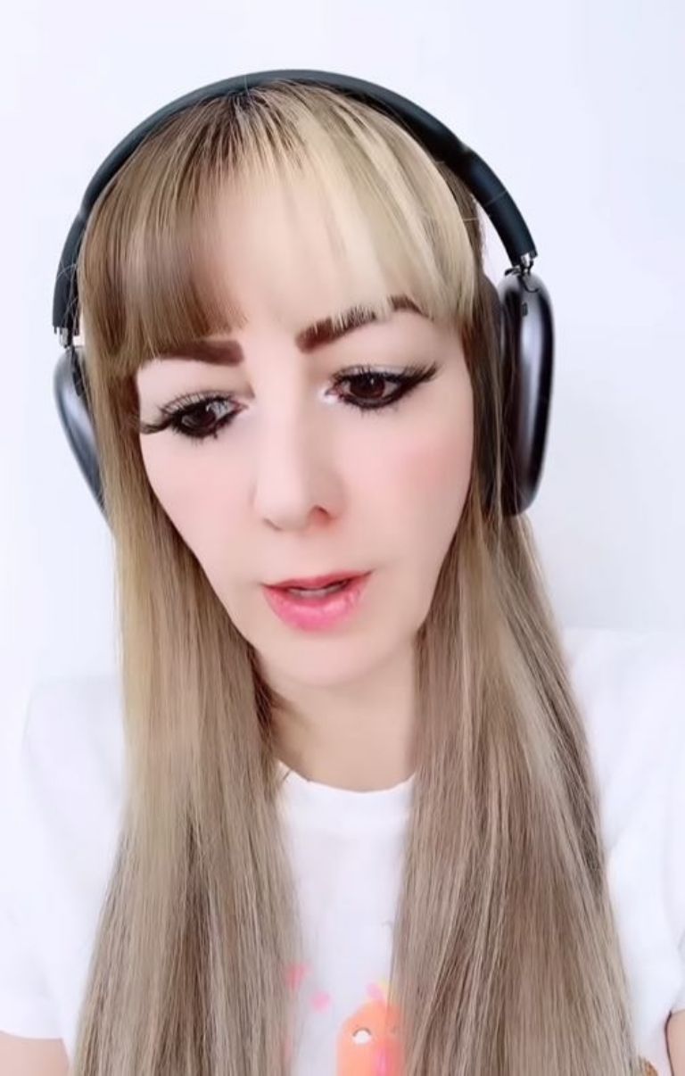Vanesa narró que está perdiendo el cabello