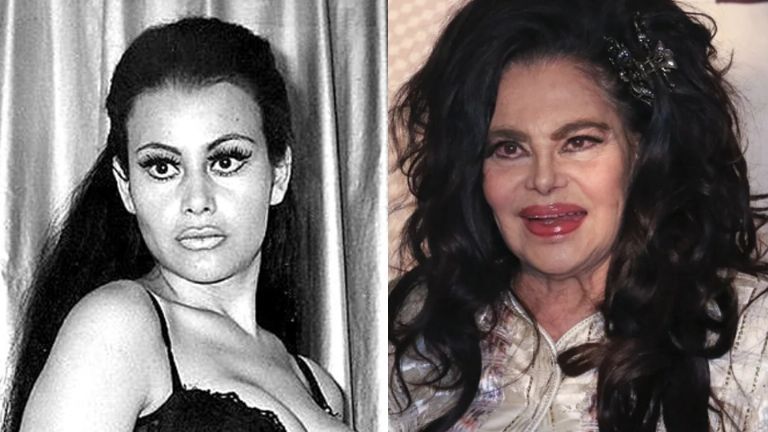 Antes y después de Rossy Mendoza