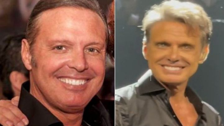Cirujano exhibe a Luis Miguel y filtra qué cirugías se hizo tras reaparecer irreconocible en show