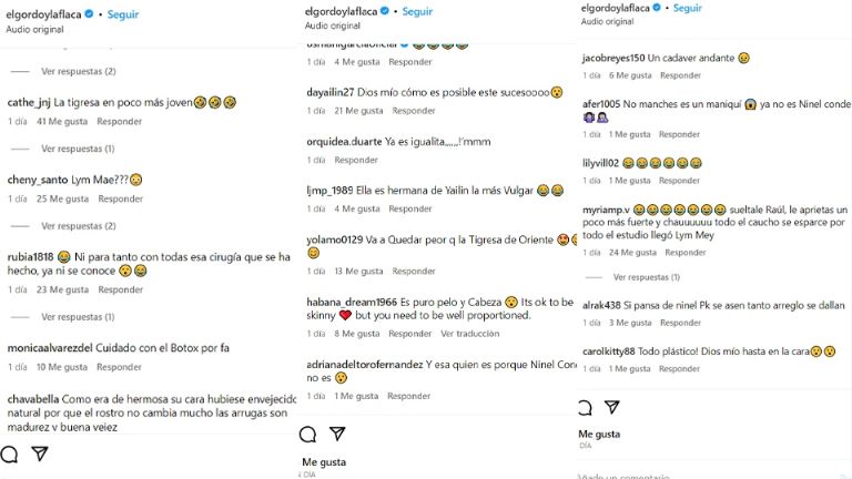 Critican a Ninel Conde por operada