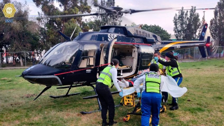 Abuelito se electrocuta en Álvaro Obregón; termina con quemaduras en todo el cuerpo