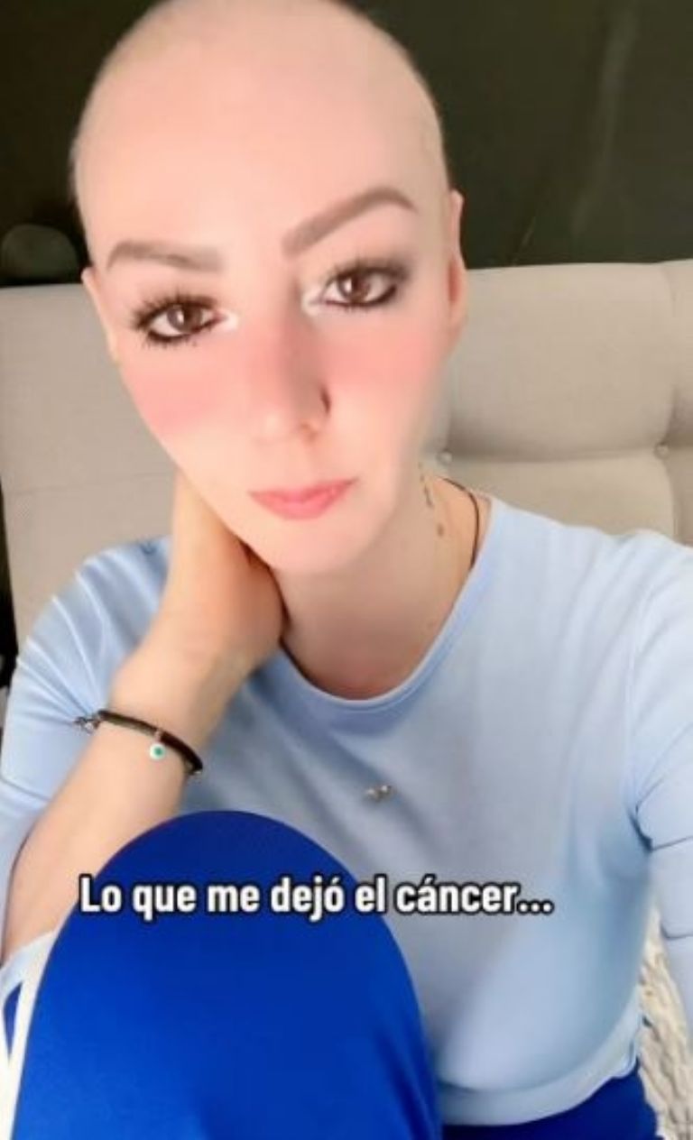 Vanessa Villagrán se muestra sin cabello en Instagram