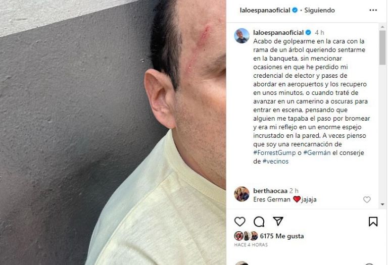 Eduardo España se lleva tremendo golpe y termina herido