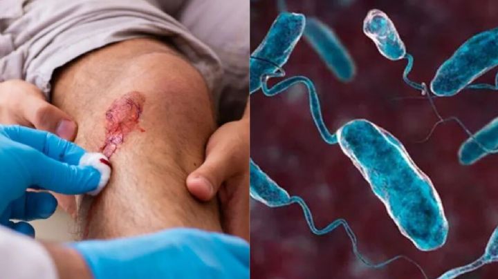 ¿Ya está en México? Alertan sobre Vibrio vulnificus, bacteria come carne en el mar caribe